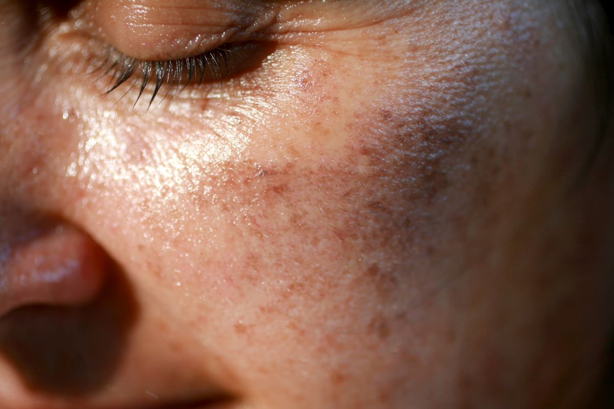 closeup of womans cheek